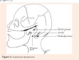 Image for the poem Laryngeal Spasm