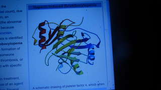 Image for the poem Heparin-induced thrombocytopenia (HIT) 