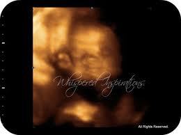 Image for the poem Lost In Utero