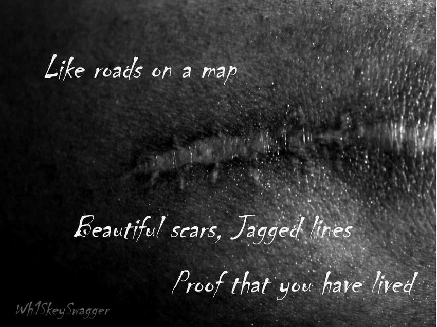 Visual Poem Beautiful Scars