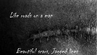 Beautiful Scars