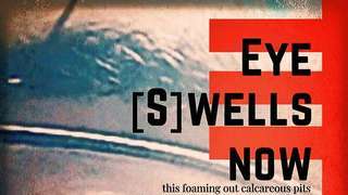 ~EYE. [S]WELLS. NOW 